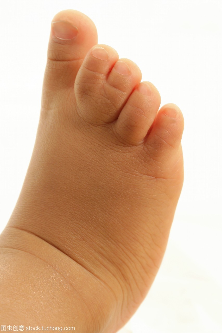 1岁到10岁,混血,科技医疗,1 to 10 years old,小孩,男孩,脚,婴儿,男人,1岁到5岁,一个,孩子,小孩子,脚趾,人,肢体,稚子,医学,下肢,1 to 5 years old,快乐童年,people,toe,man,lower limb,boy,baby,medicine,one,mixed origins,foot,congenital condition,genetic disease,syndactyly,malformation,bsip,limb